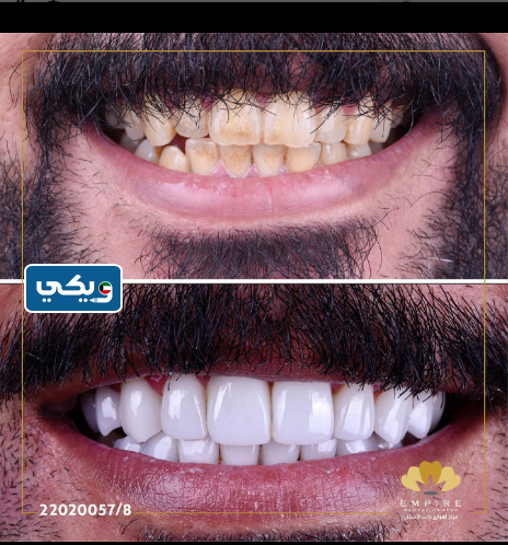 مركز إمباير لطب الأسنان