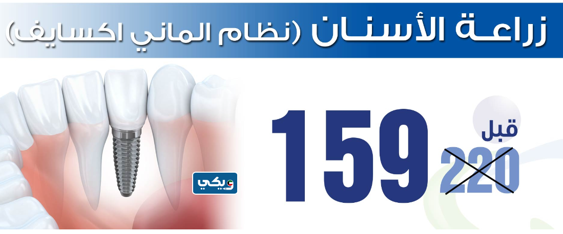 عروض أسعار مركز اكنان لطب الاسنان - شرق