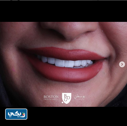 مجموعة بوسطن لطب الاسنان