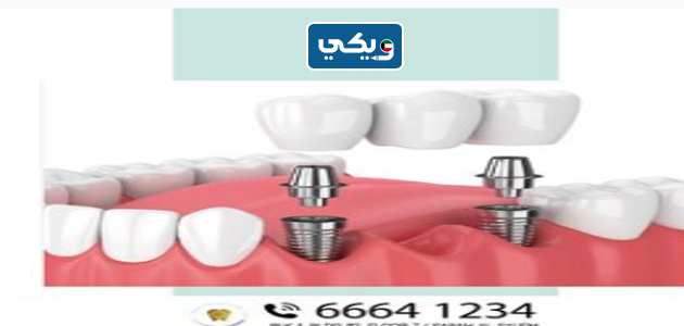 مركز سمايل زون لطب الأسنان
