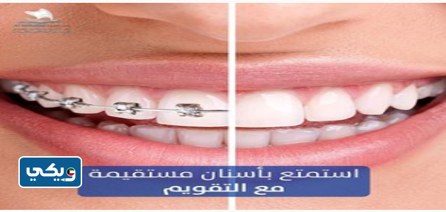 مركز المهلب التخصصي لطب الأسنان