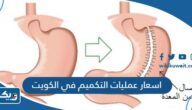 اسعار عمليات التكميم في الكويت 2025 اسعار عمليات التكميم في الكويت 2025