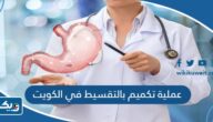 عملية تكميم بالتقسيط في الكويت 2025 عملية تكميم بالتقسيط في الكويت 2025
