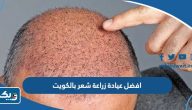 افضل عيادة زراعة شعر بالكويت افضل عيادة زراعة شعر بالكويت