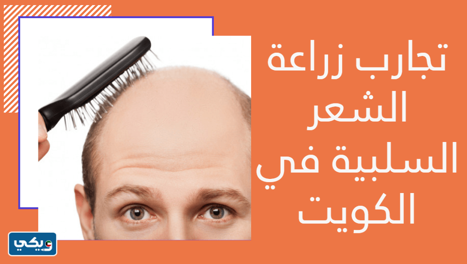 تجارب زراعة الشعر السلبية في الكويت