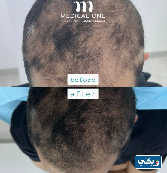 مستوصف ميديكال ون التخصصي