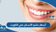 أسعار حشو الأسنان في الكويت 2026 أسعار حشو الأسنان في الكويت 2026