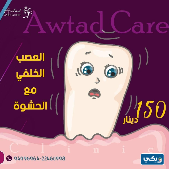 أسعار حشوة العصب في أوتاد كير