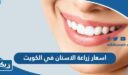 اسعار زراعة الاسنان في الكويت 2026