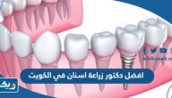 افضل دكتور زراعة اسنان في الكويت افضل دكتور زراعة اسنان في الكويت