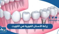 زراعة الأسنان الفورية في الكويت 2025 الاسعار والعيادات