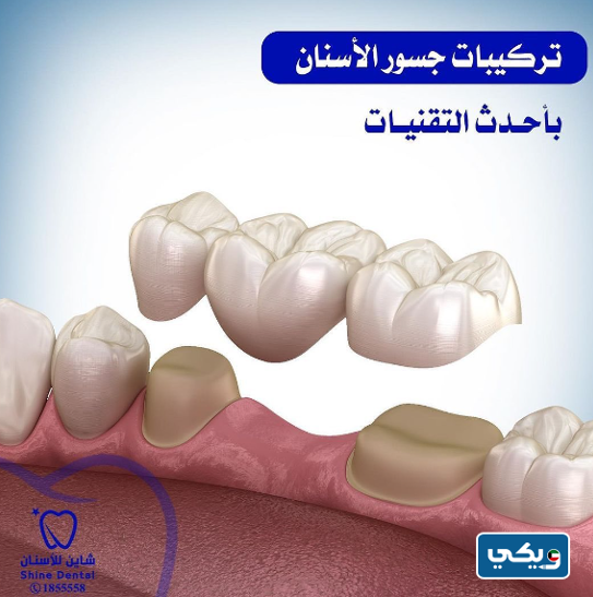 عيادة شاين للأسنان