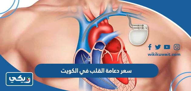 سعر دعامة القلب في الكويت