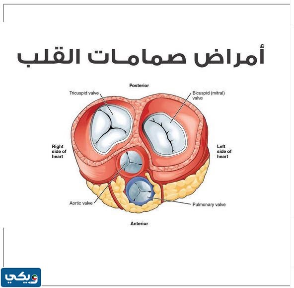 سعر عملية تغيير صمام القلب في الكويت