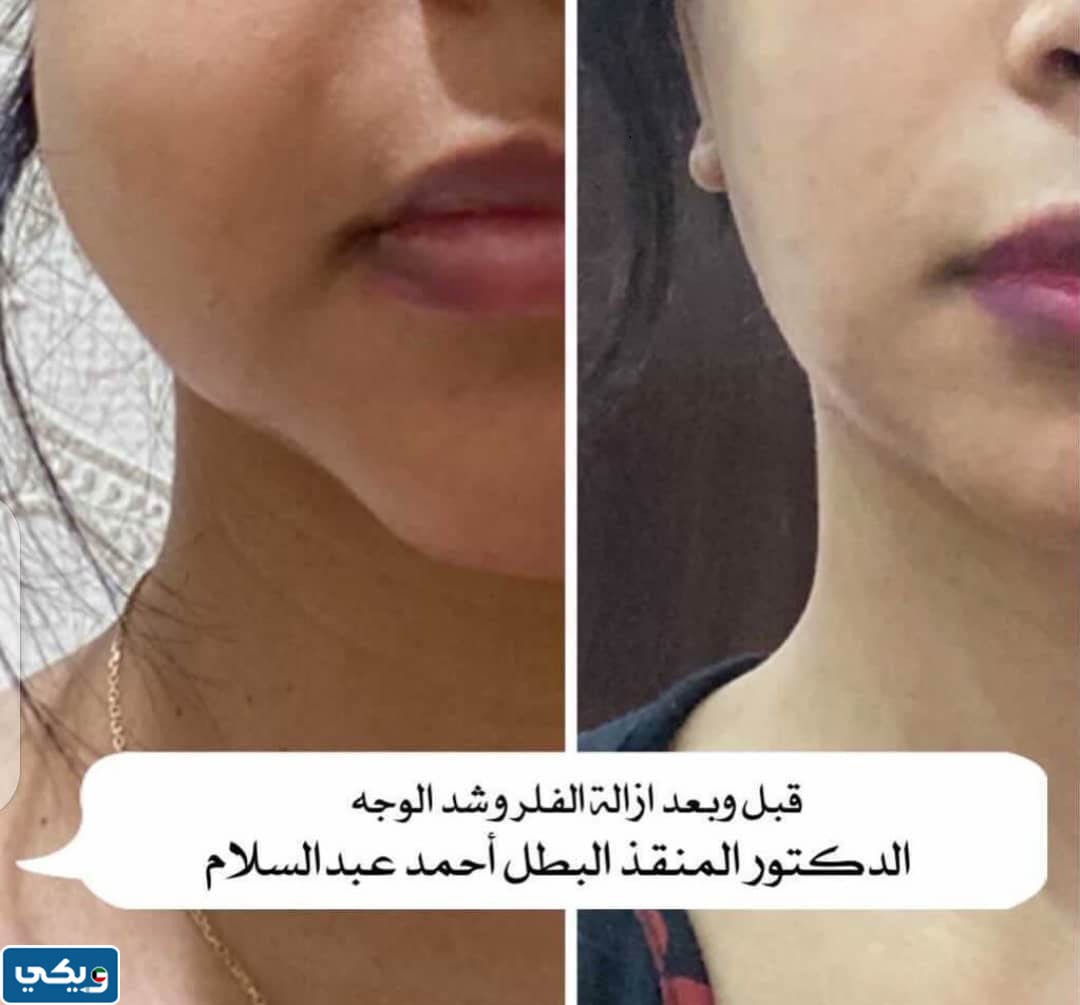 تجربتي مع الدكتور احمد عبدالسلام