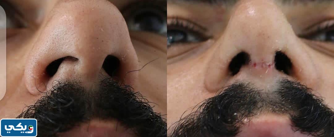 تجربتي مع الدكتور احمد عبدالسلام