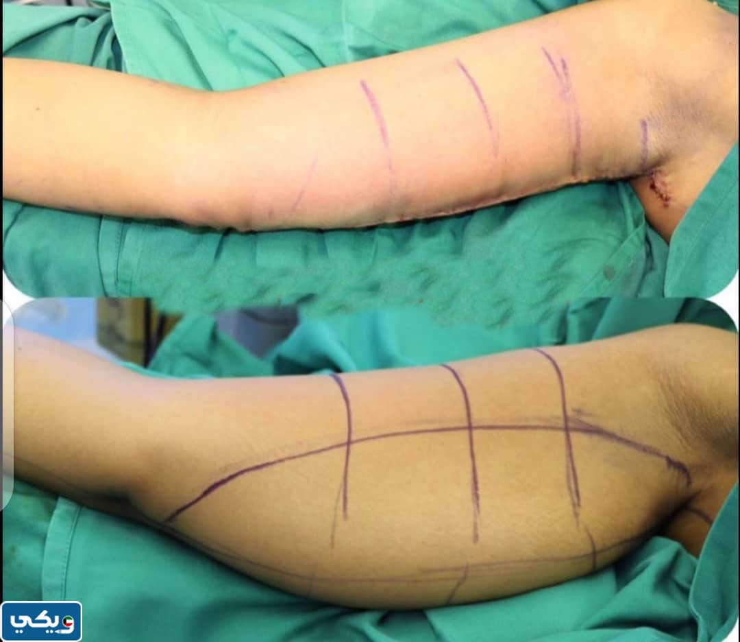 تجربتي مع الدكتور احمد عبدالسلام