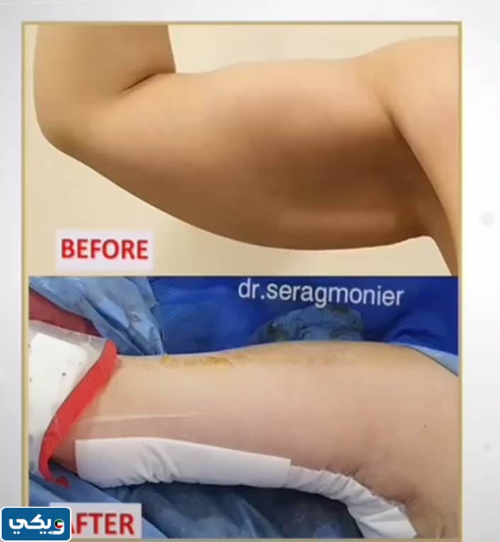 تجربتي مع  الدكتور سراج منير