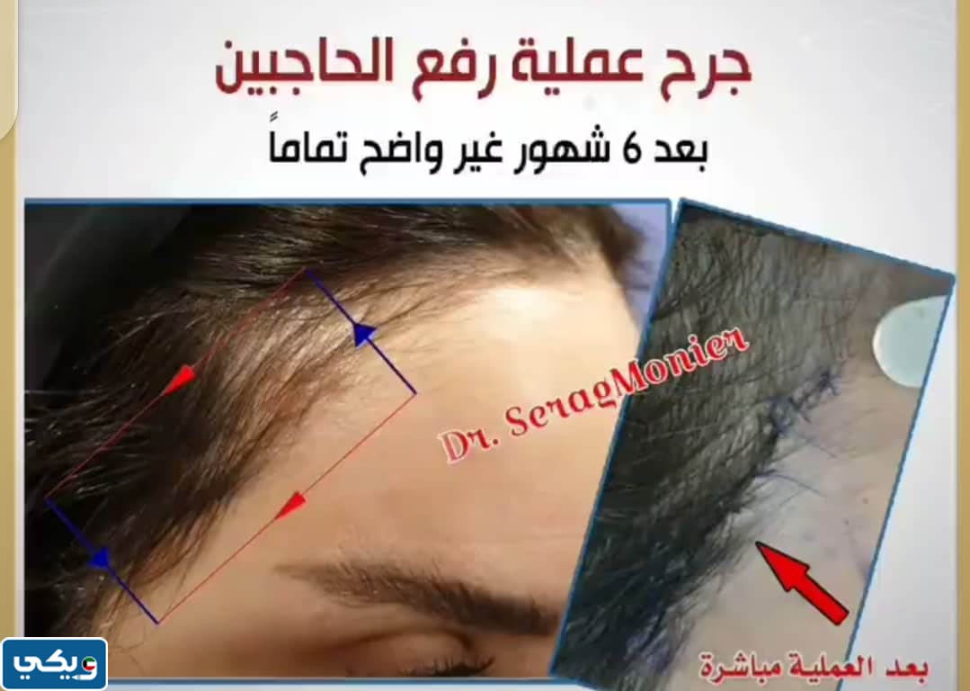 تجربتي مع  الدكتور سراج منير