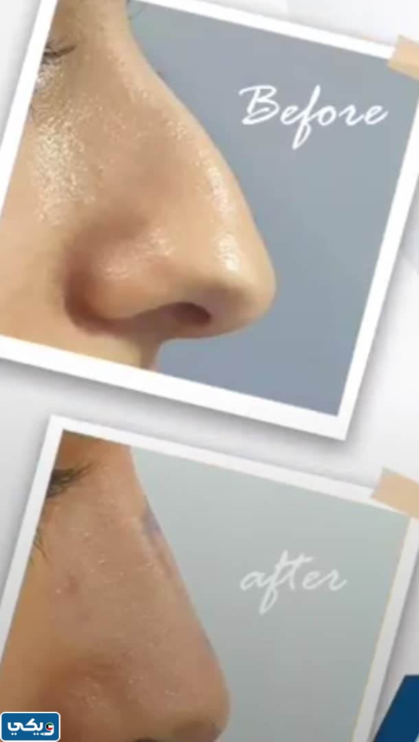 تجربتي مع  الدكتور سراج منير