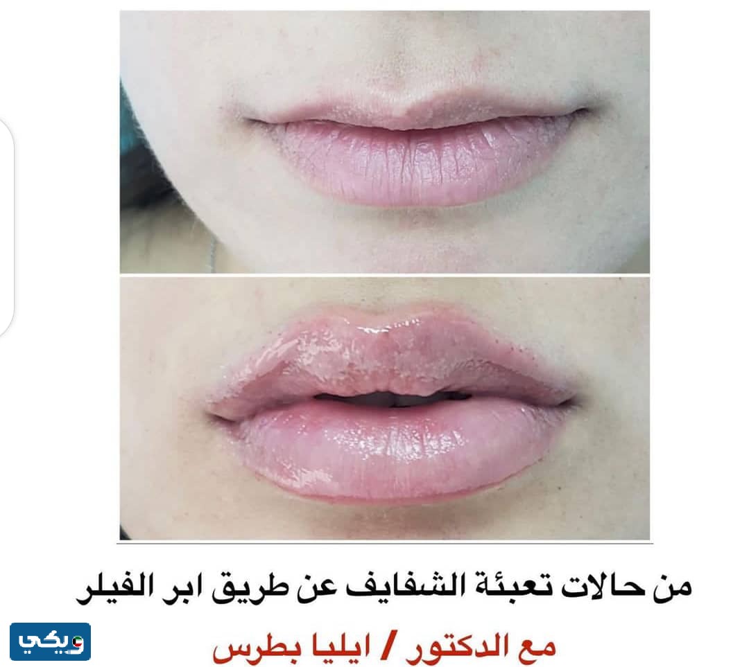تجربتي مع الدكتور ايليا بطرس