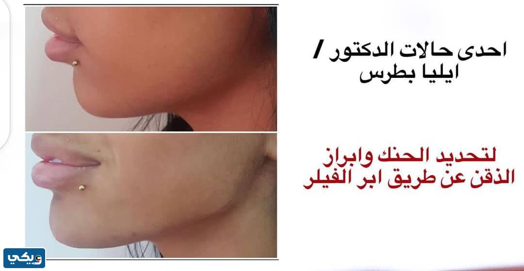 تجربتي مع الدكتور ايليا بطرس
