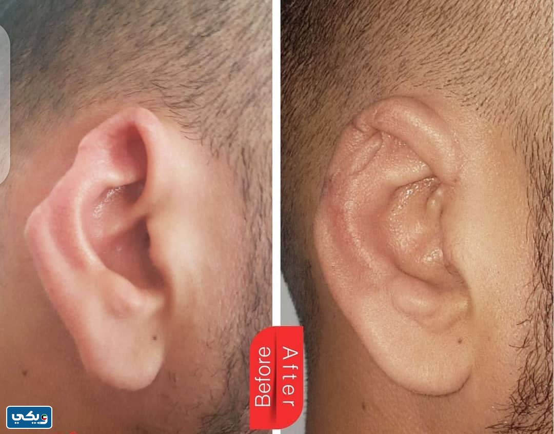 تجربتي مع الدكتور ايليا بطرس