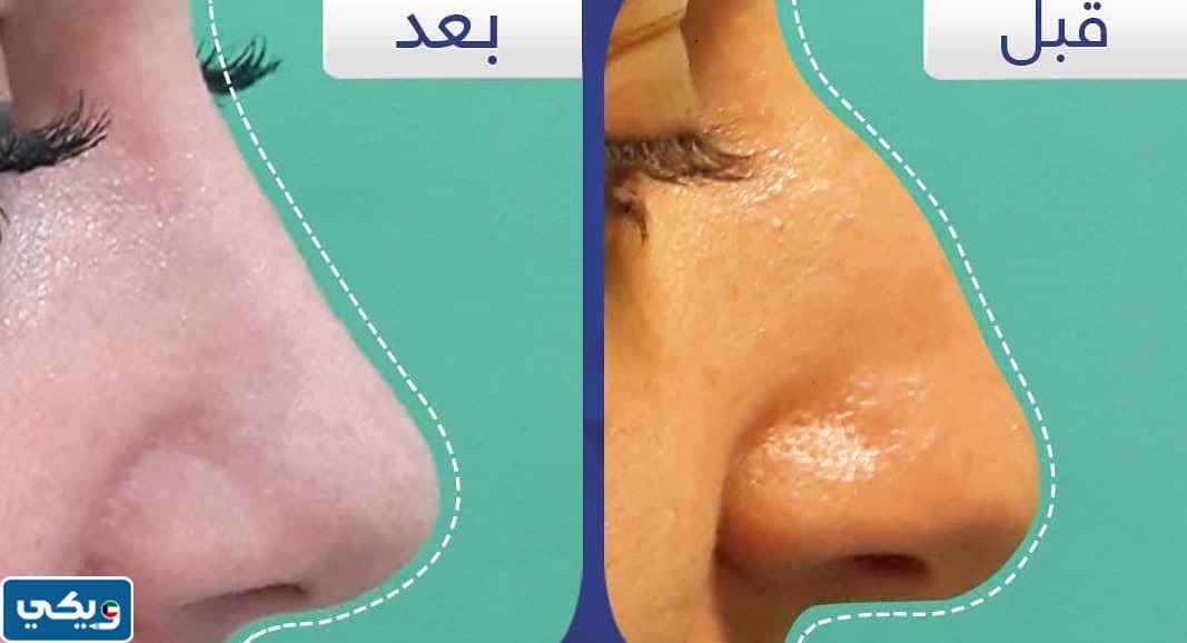 تجربتي مع  الدكتور ممدوح الضاوي
