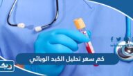 كم سعر تحليل الكبد الوبائي في الكويت كم سعر تحليل الكبد الوبائي في الكويت