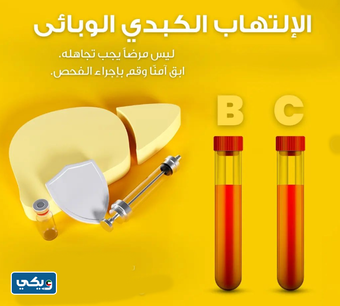 كم سعر تحليل الكبد الوبائي في الكويت