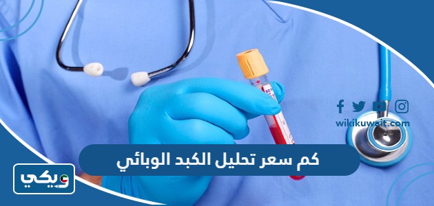 كم سعر تحليل الكبد الوبائي