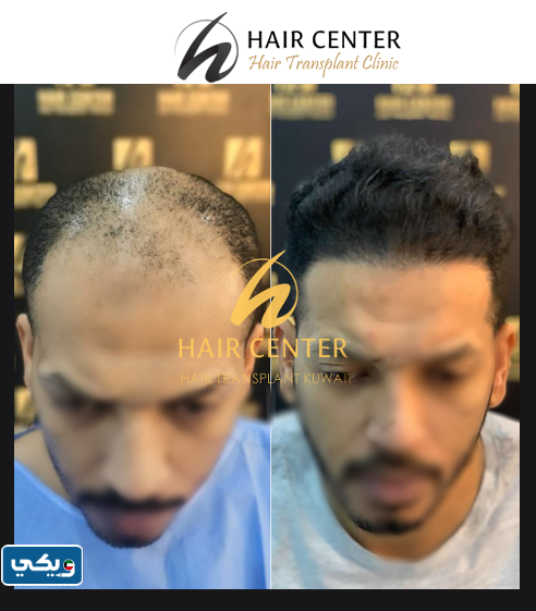 مركز بادي للشعر