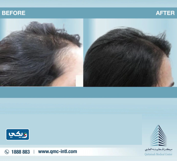 مركز قطينة الطبي QMC