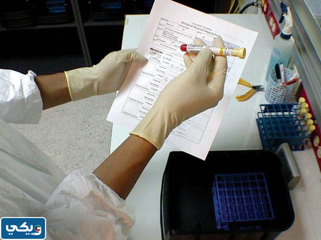 كم سعر فحص الايدز في الكويت 2023