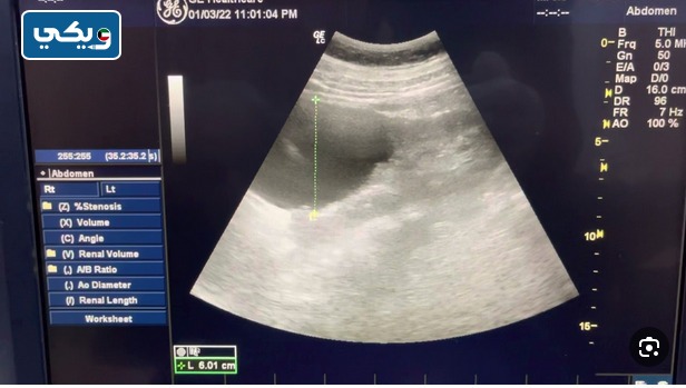 سعر السونار في ياكو ابولو