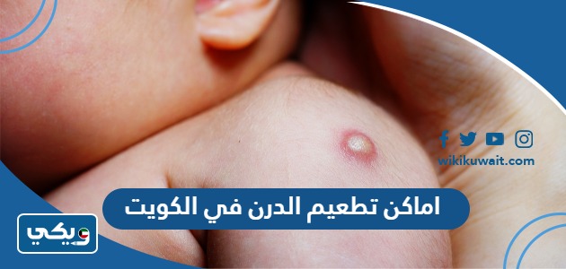 اماكن تطعيم الدرن في الكويت