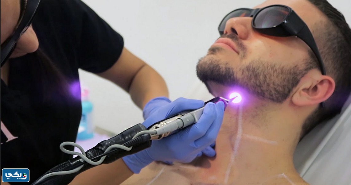 عيادة ليزر للشعر الأبيض في الكويت