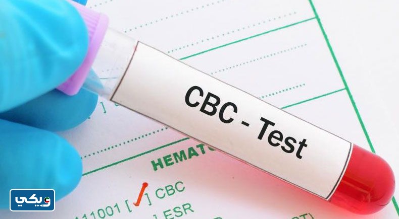 ما هو تحليل cbc