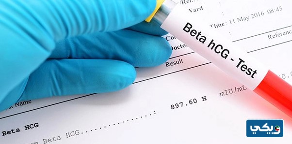 متى يظهر هرمون الحمل في الدم