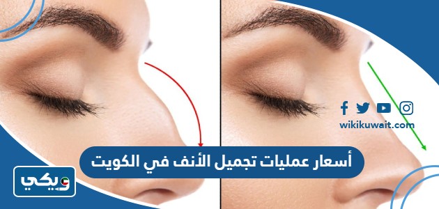 أسعار عمليات تجميل الأنف في الكويت
