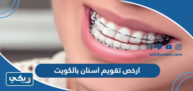 ارخص تقويم اسنان بالكويت