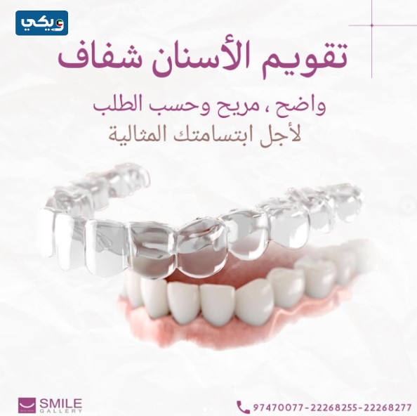 سعر تقويم الأسنان في عيادة سمايل جاليري