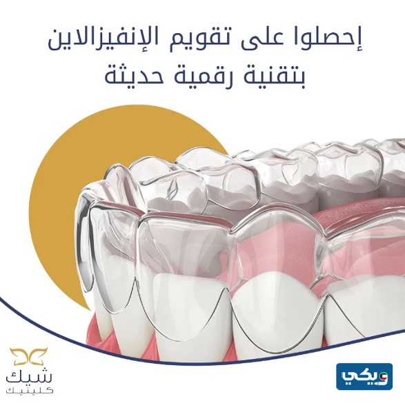 سعر تقويم الأسنان في مركز شيك كلينك لطب الأسنان